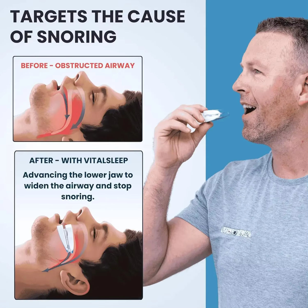 Medical Silicone Anti-Snoring Mouthpiece & Bruxism Sleep Aid Guard